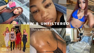 First International Brand Trip ✈️ + Getting Lipo 360 & Fat Transfer to My Hips in Turkey 🇹🇷