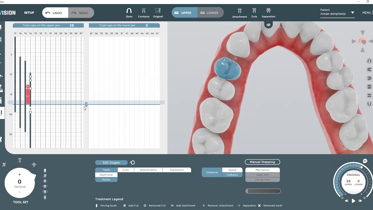 Streamline Dental Treatment Planning | Copy, paste key points