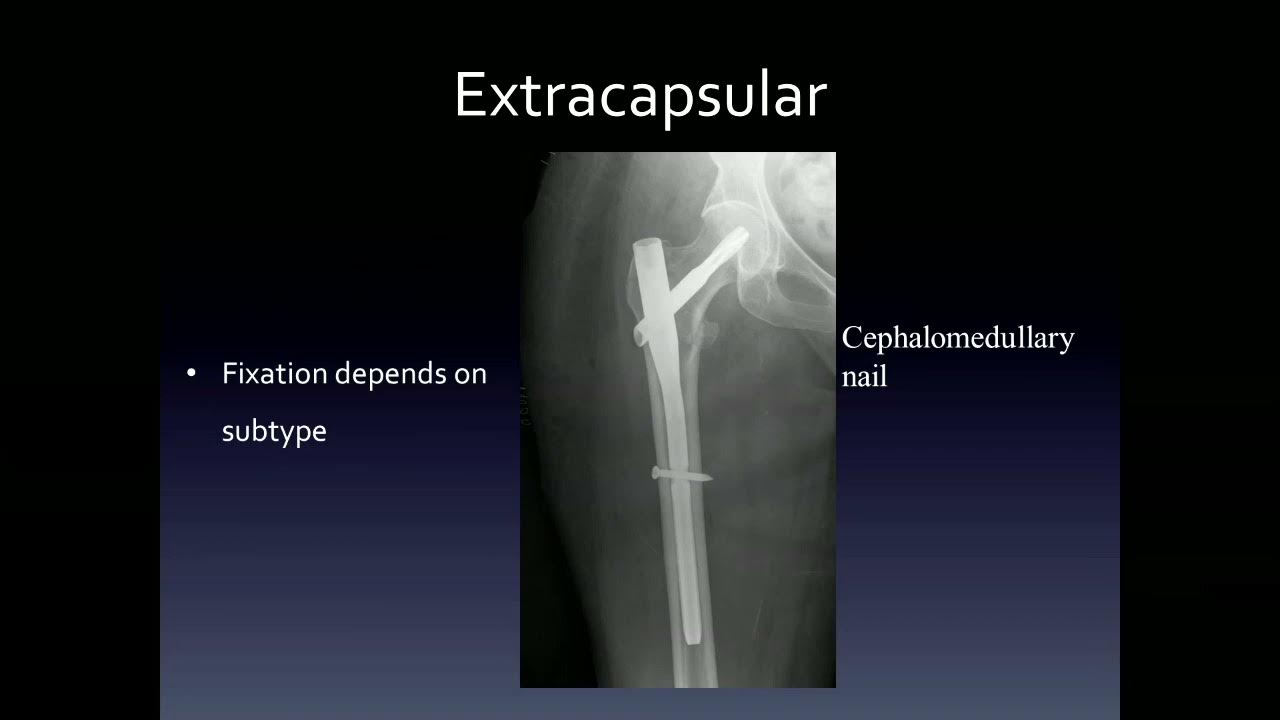 Orthopedic imaging - YouTube