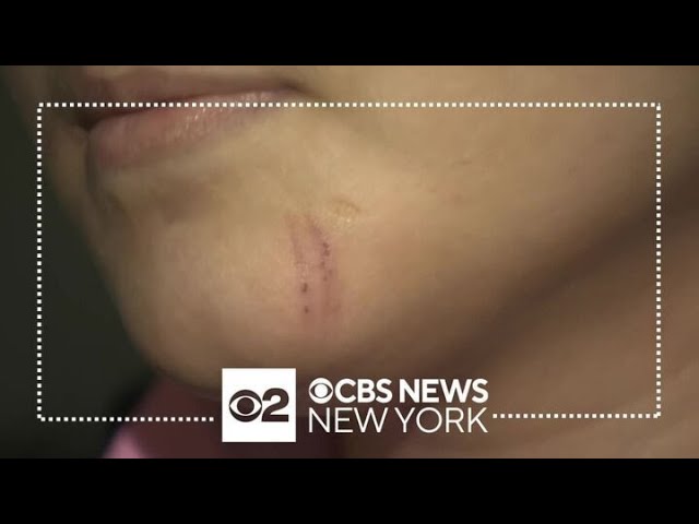 17 Year Old Talks About Defending Pregnant Sister From Assault In Nyc Subway System