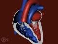 The structure of a heart with transposition of the great arteries tga  chop