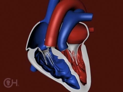 Video: Computationeel Medisch Beeldvormings- En Hemodynamiekraamwerk Voor Functionele Analyse En Beoordeling Van Cardiovasculaire Structuren