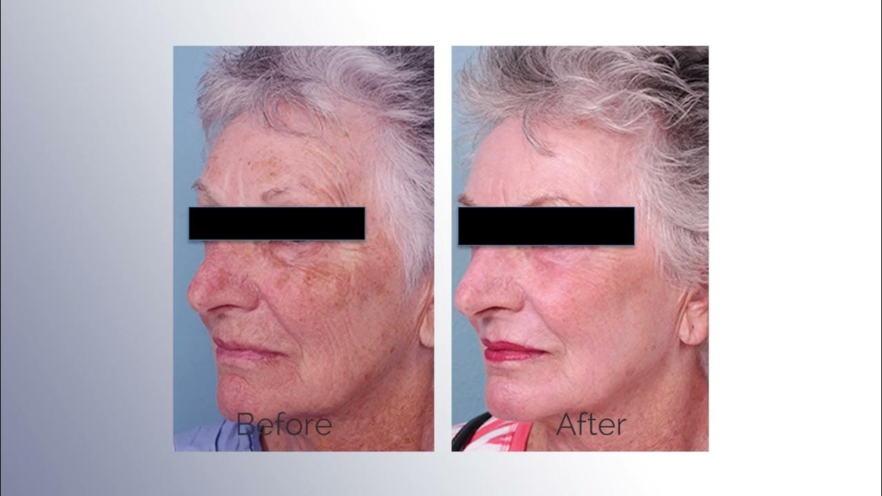 The Spectrum Device Overview YouTube