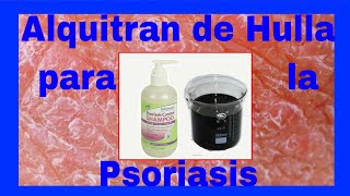 ⚱⚱ Alquitrán de Hulla para la Psoriasis ⚱⚱