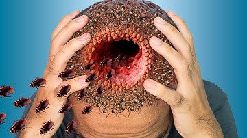 Deep Cleaning Animation - ASMR Removing Ticks, Maggots and insects from Head