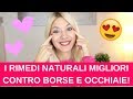 6 RIMEDI NATURALI DAVVERO EFFICACI contro BORSE e OCCHIAIE!