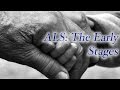 ALS: The Early Stages