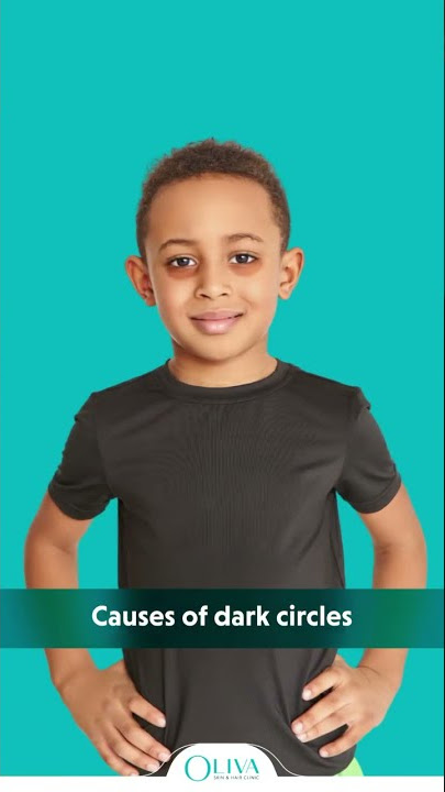 Dark Circles Under Eyes? 3 Reasons Which May Causes Dark Circles.