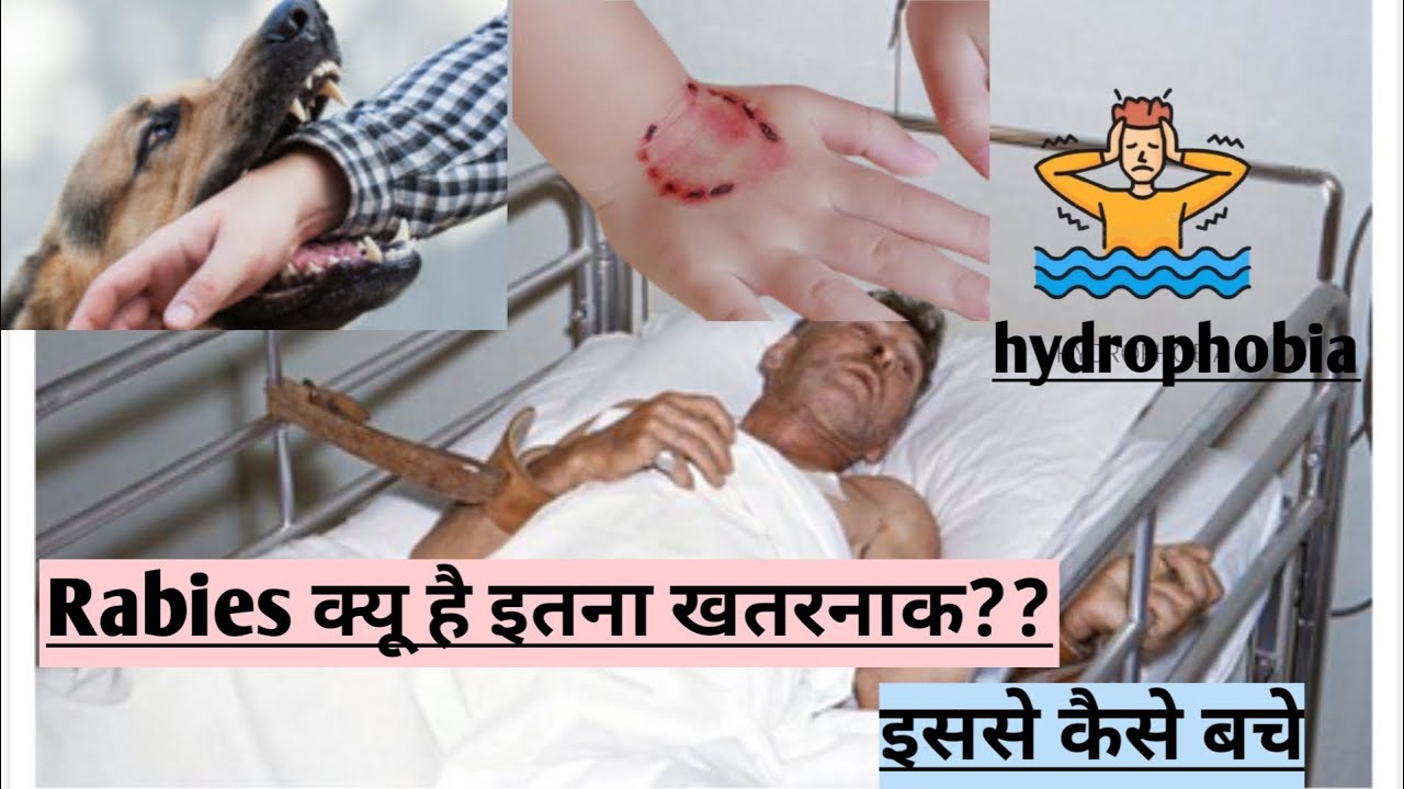 Rabies|| rabies kya hai||symptoms of rabies and prevention for rabies 👨‍⚕️🏥💉⚕️