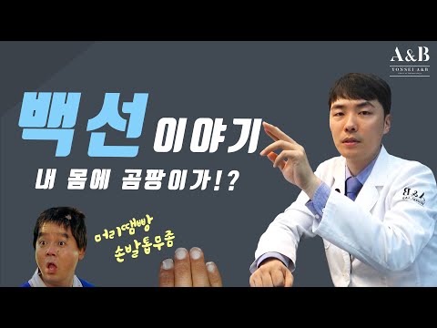 백선은 무엇인가요? 백선증은 치료할수 있는건가요? / 연세에이앤비피부과 이해진원장