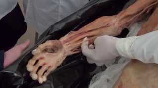 видео Анатомия мышц рук