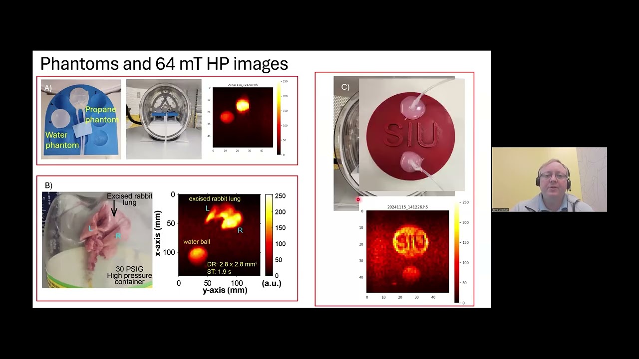 Hyperpolarized Gas Imaging of Lung Ventilation in a Clinical “Point-of-Care” Portable MRI Scanner