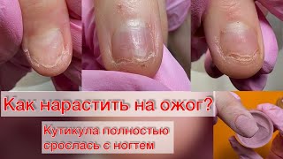 HOW TO CARE FOR A BURN? WHAT CAN YOU COAT NAILS AFTER A BURN? Dip system. Titanium nails