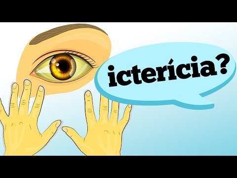 Vídeo: Diferença Entre Icterícia E Icterícia