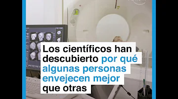 ¿Por qué algunas personas no envejecen?