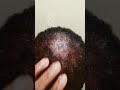 June 29, 2023 Dominican magic Bella Impression good for hair loss, in man and women