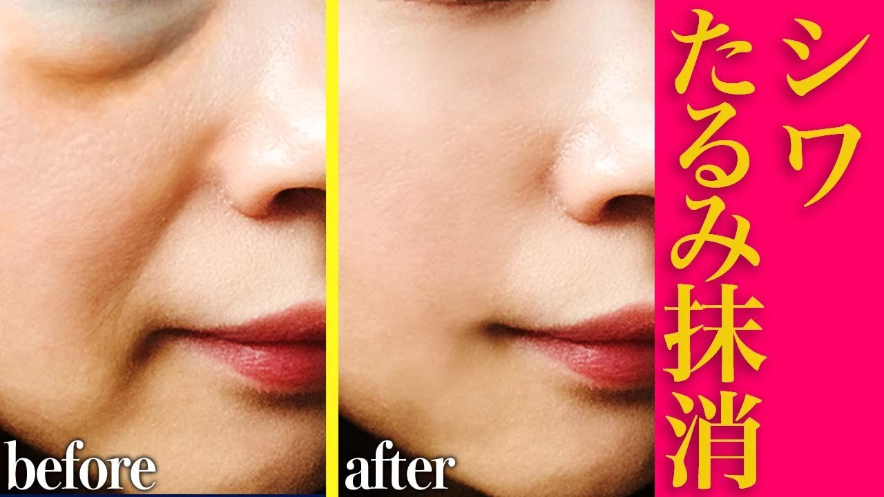 整形級 1分で老け顔を解消する最強の方法 Youtube