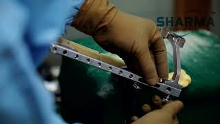 Sharma Orthopedic - Humerus Nail Helical Blade Nailing System