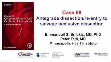 Case 98: Manual of CTO Interventions: Re-entry to recanalize a dissected vessel