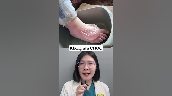 Review - Bóng nước do Bỏng - phải làm sao? #thsbsphuongquy #review #reaction #shorts
