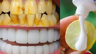 सिर्फ 2 मिनट में गंदे दांतों को मोती की तरह चमका देगा यह घरेलू नुस्खा Teeth Whitening Remedy