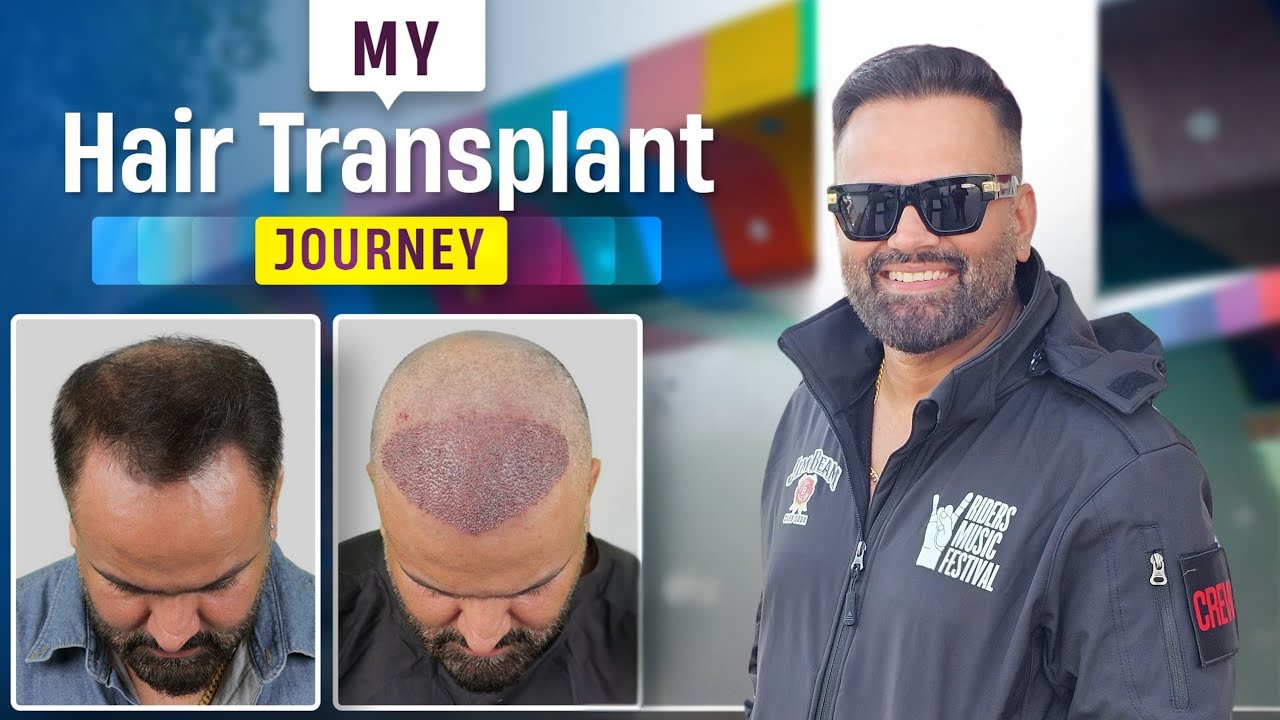 BAAL AA GAYE OYEEEEEEE 👨‍🦲🧔‍♂️😂 , AB VIDEO KAB AEGA ?