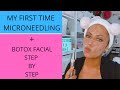COSMETIC MICRONEEDLING/ + BOTOX FACIAL/ Step by Step