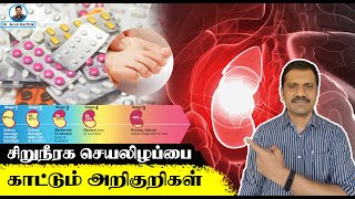 KIDNEY FAILIURE SYMPTOMS,TESTS &  DIET FOR KIDNEY FAILIURE  IN TAMIL ||#DR_ARUNKARTHIK