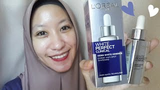 Loreal White Perfect Day Cream | Skin Whitening Cream | Itsarpitatime