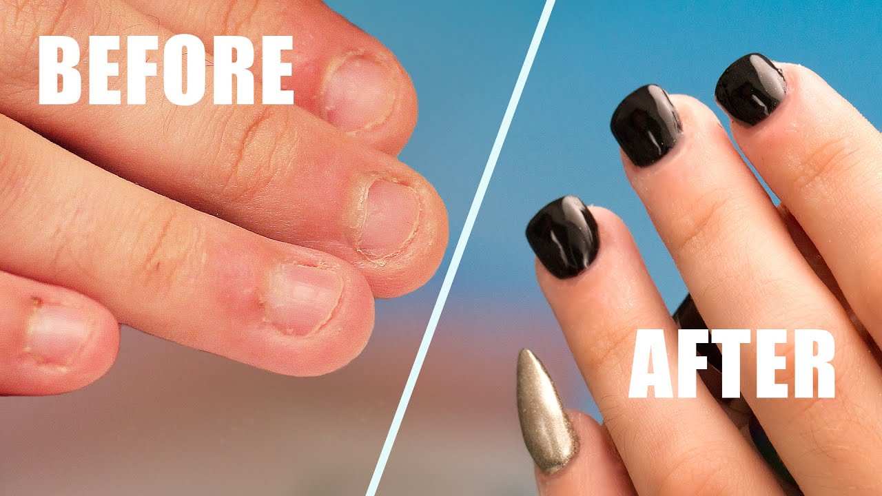 Fix Short Bitten Nails With Acrylic Youtube