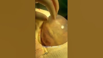 Amniotic fluid membrane || Amniotic fluid sac || Amniotic fluid || @nursing_notes_2710