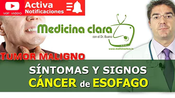 ¿Siente un tumor al tragar?