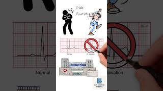 56-Year-Old With Chest Pain… What Would YOU Do?