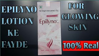 EPILYNO LOTION KE BENIFITS || For Glowing Skin || Review By Vikas Thakur || 100% Real