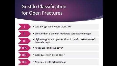Coding for Fracture Care: Gustilo Classification for Open Fractures