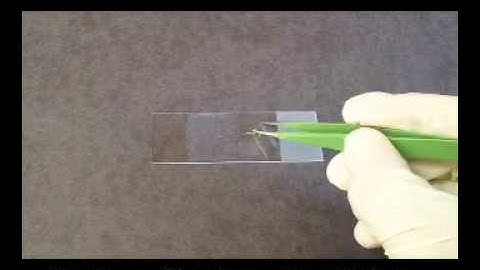 Mechanical fixation: agarose method.