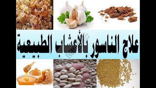 علاج الناسور بالأعشاب