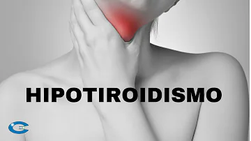 ¿Por qué empeora mi hipotiroidismo?