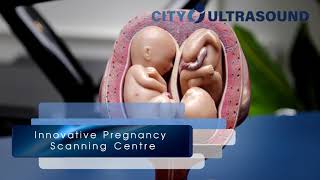 City Ultrasound: Innovative Pregnancy Scan Centre in the Heart of London