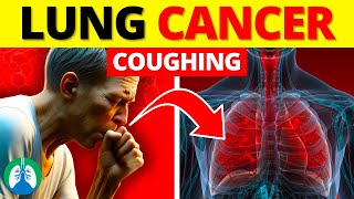 Persistent Cough and Lung Cancer | EXPLAINED ⚠️ by Respiratory Therapy Zone 1,694 views 3 weeks ago 3 minutes, 5 seconds