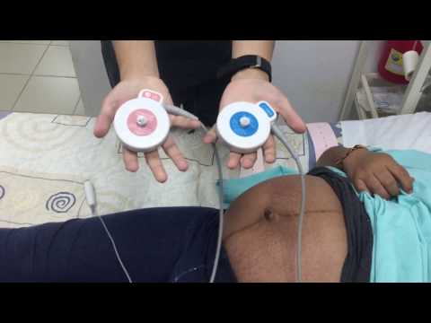 Video: Cómo Completar La Prueba De Movimiento Fetal