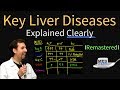 Diagnosis of Key Liver Diseases - Hepatitis A, B, C vs. Alcoholic vs. Ischemic (AST vs ALT Labs)