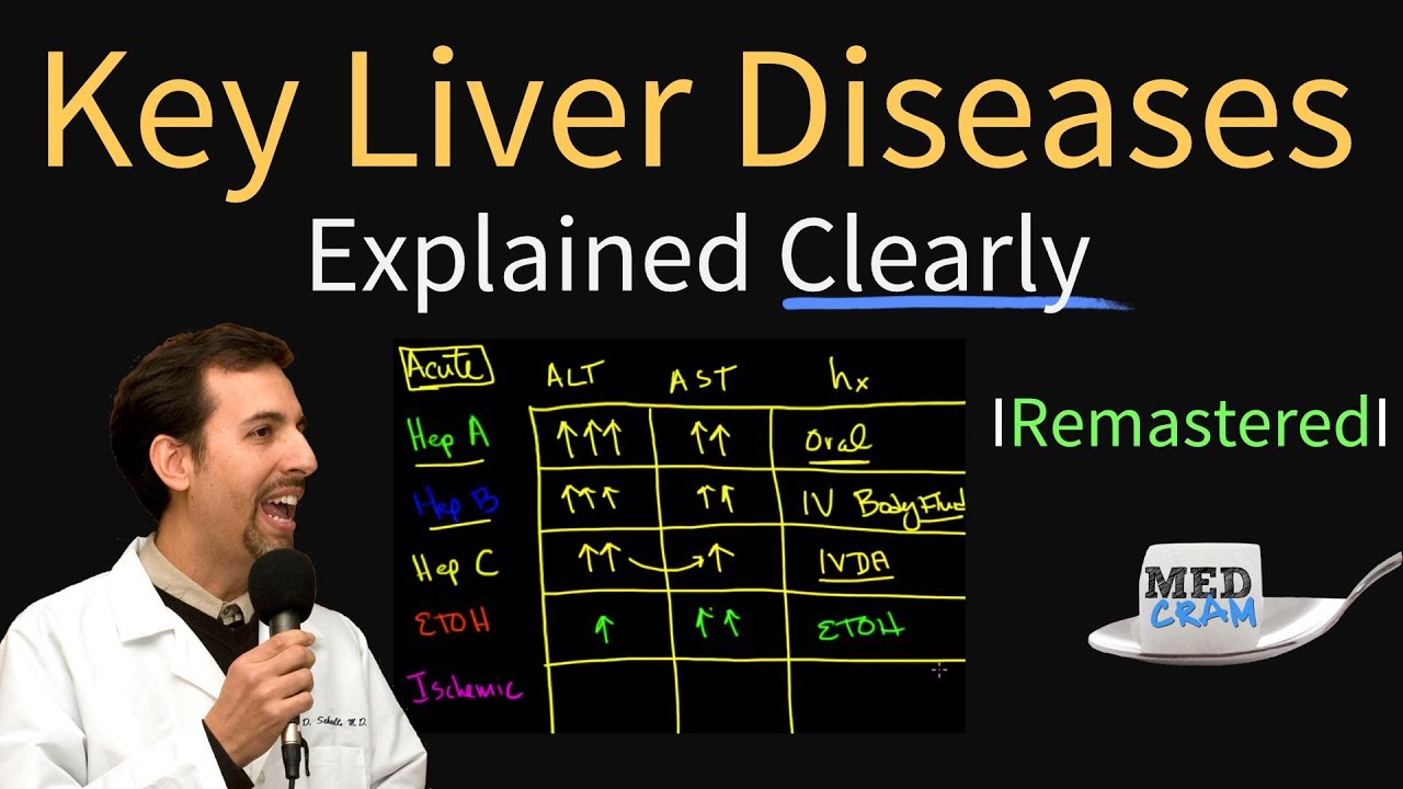 ⁣Diagnosis of Key Liver Diseases - Hepatitis A, B, C vs. Alcoholic vs. Ischemic (AST vs ALT Labs)