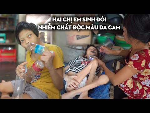 Tác Hại Của Chất Độc Màu Da Cam - SỰ TÀN PHÁ KINH HỒN CỦA CHẤT ĐỘC MÀU DA CAM