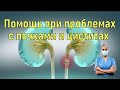 Первая помощь при проблемах с почками и цистите. Фитолизин паста