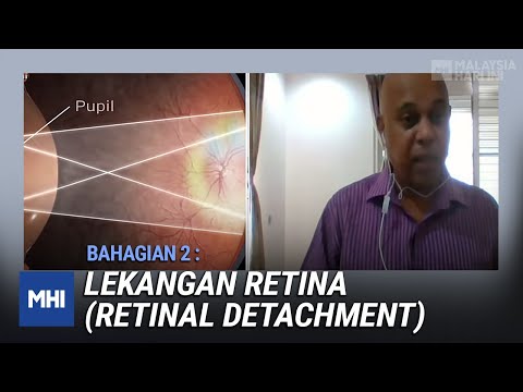 Video: Mengapa retina tertanggal berlaku?