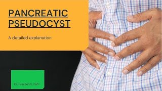 Pancreatic Pseudocyst - Dr Praveen Patil