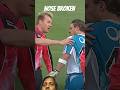 Brett Lee left Mccallum with bloody nose#cricket#bbl#viral#trending#ytshorts