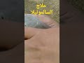 علاج السالمونيلا عند الحمام بطريقه زمان اقوى أجمل حمامه حمامابنالغلابه