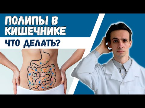 Полипы в кишечнике 🥜 Опасны ли? Диагностика. Лечение. Профилактика